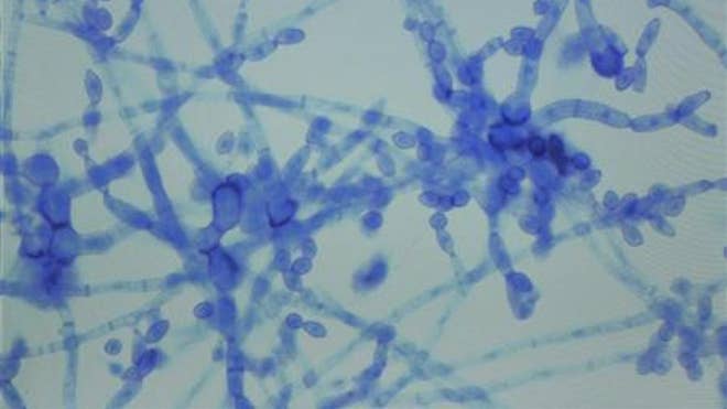 meningitis fungus